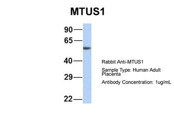 MTUS1 Rabbit Polyclonal Antibody
