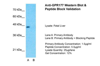 GPR177 Rabbit Polyclonal Antibody