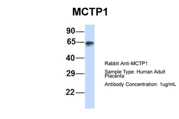 MCTP1 Rabbit Polyclonal Antibody