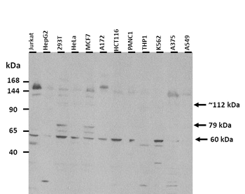 MCTP1 Rabbit Polyclonal Antibody