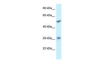 ITM2C Rabbit Polyclonal Antibody