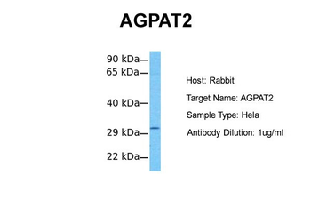 AGPAT2 Rabbit Polyclonal Antibody