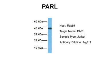 PARL Rabbit Polyclonal Antibody