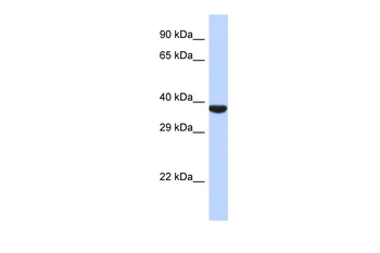 TMPPE Rabbit Polyclonal Antibody