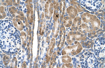FAM55D Rabbit Polyclonal Antibody