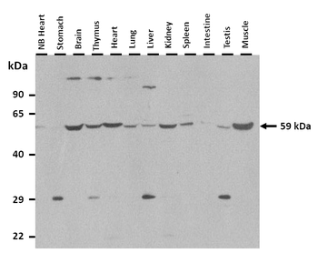 Dct Rabbit Polyclonal Antibody