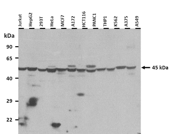 IHH Rabbit Polyclonal Antibody