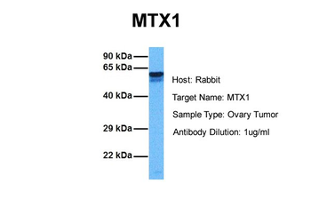 MTX1 Rabbit Polyclonal Antibody