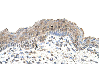 TAPBP Rabbit Polyclonal Antibody