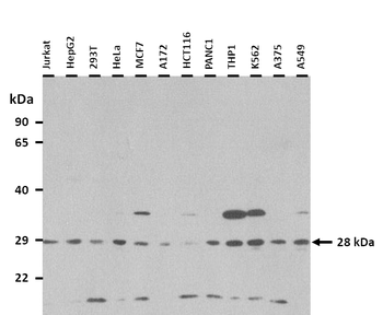 TSPAN6 Rabbit Polyclonal Antibody