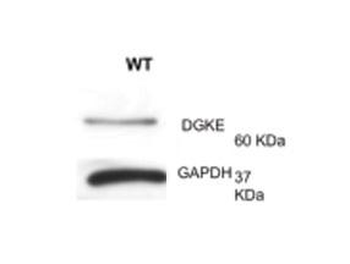 DGKE Rabbit Polyclonal Antibody