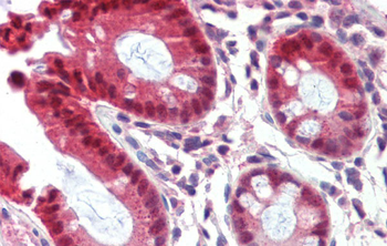 NR1I3 Rabbit Polyclonal Antibody