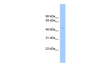 NR1H2 Rabbit Polyclonal Antibody