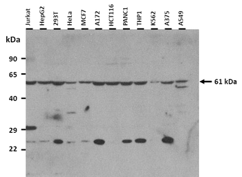 GLUD1 Rabbit Polyclonal Antibody