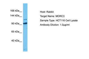 MORC3 Rabbit Polyclonal Antibody