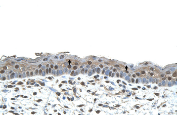 CENPA Rabbit Polyclonal Antibody