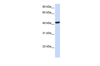 SKAP1 Rabbit Polyclonal Antibody