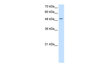 EIF2S3 Rabbit Polyclonal Antibody
