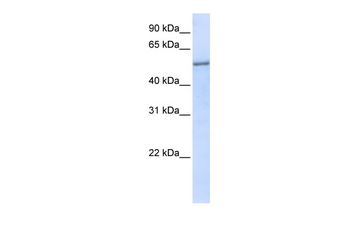 EIF2S3 Rabbit Polyclonal Antibody