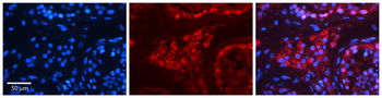HSPA4 Rabbit Polyclonal Antibody