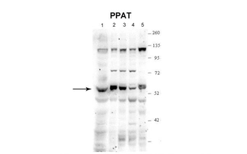 PPAT Rabbit Polyclonal Antibody