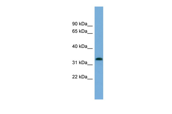 IFI35 Rabbit Polyclonal Antibody