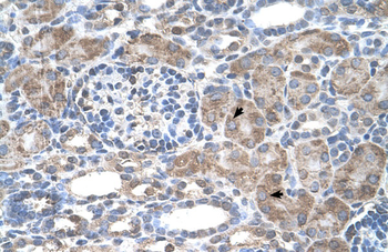 IFI44L Rabbit Polyclonal Antibody