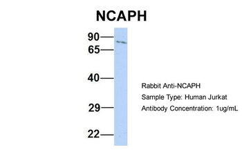 NCAPH Rabbit Polyclonal Antibody