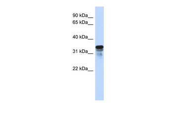 FAM82B Rabbit Polyclonal Antibody