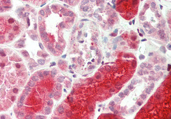 NIT2 Rabbit Polyclonal Antibody