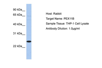 PEX11B Rabbit Polyclonal Antibody