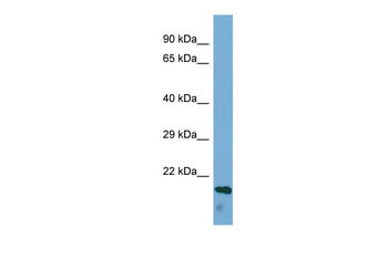 ECM1 Rabbit Polyclonal Antibody