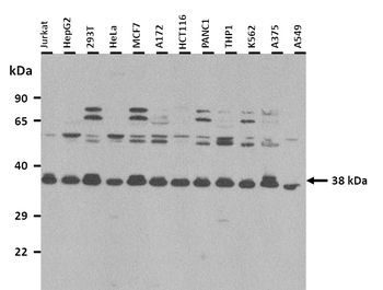 EFNB1 Rabbit Polyclonal Antibody