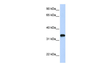 HAS3 Rabbit Polyclonal Antibody
