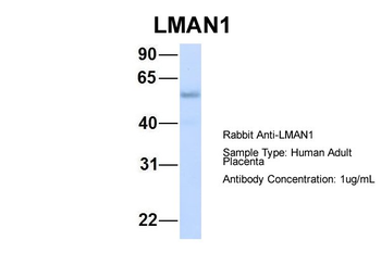 LMAN1 Rabbit Polyclonal Antibody