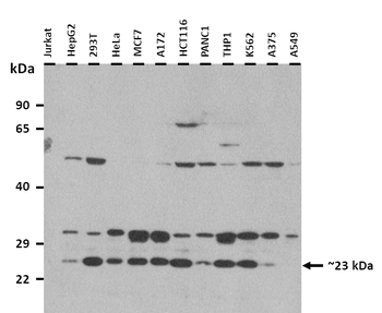 TSPAN31 Rabbit Polyclonal Antibody