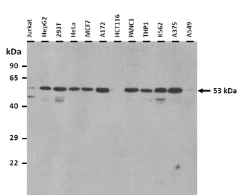 SPTLC1 Rabbit Polyclonal Antibody