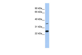 LYVE1 Rabbit Polyclonal Antibody