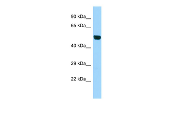 B4GAT1 Rabbit Polyclonal Antibody