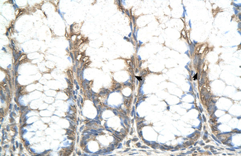 CHIC2 Rabbit Polyclonal Antibody