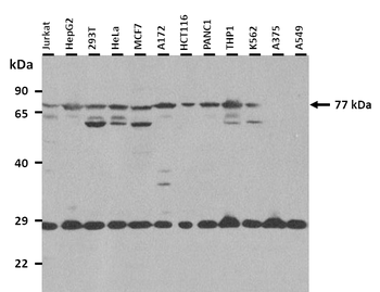 SV2B Rabbit Polyclonal Antibody