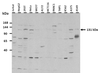 ADCY6 Rabbit Polyclonal Antibody