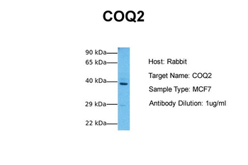 COQ2 Rabbit Polyclonal Antibody