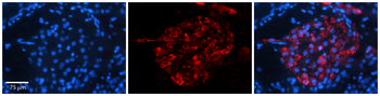 ERGIC3 Rabbit Polyclonal Antibody