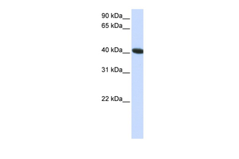 C1orf159 Rabbit Polyclonal Antibody