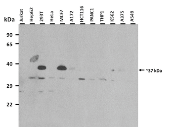 NAXD Rabbit Polyclonal Antibody