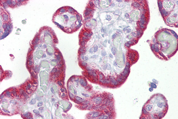 KRT23 Rabbit Polyclonal Antibody