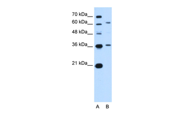 ZSCAN12 Rabbit Polyclonal Antibody