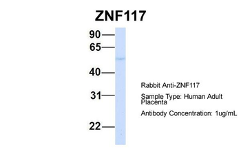 ZNF117 Rabbit Polyclonal Antibody