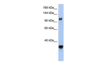 XPO5 Rabbit Polyclonal Antibody